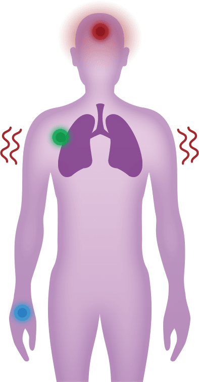 symptoms and potential impact of pneumococcal pneumonia on your head